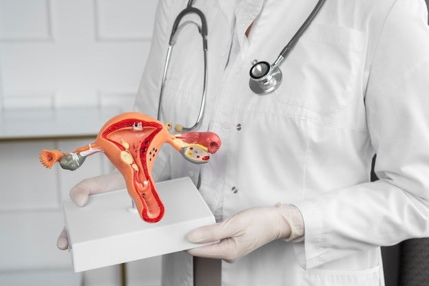 5 Signs You May Have Fibroids