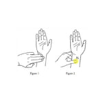morning sickness acupressure sea bands